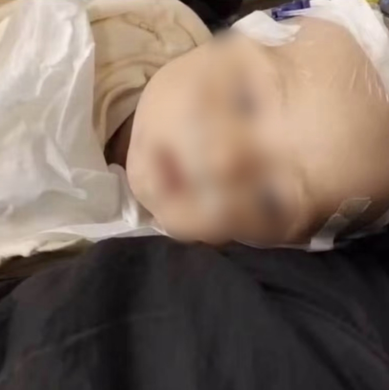 四川6月齡男嬰確診心衰、重癥肺炎：治療缺錢 母親發(fā)起求助(圖2)